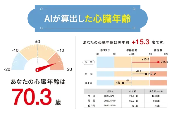 AIが算出した心臓年齢。あなたの心臓年齢は70.3歳、実年齢との差は+15.3歳