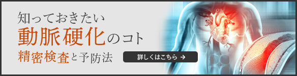 知っておきたい動脈硬化のコト―精密検査と予防法