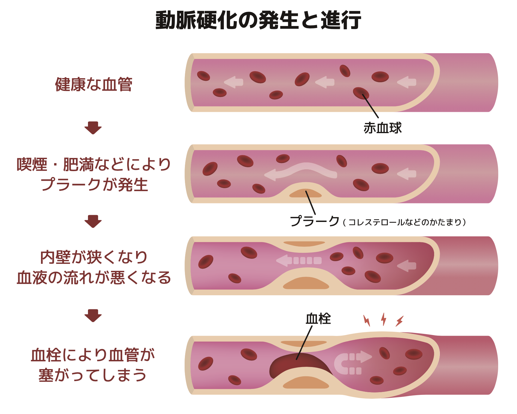 動脈硬化制御装置