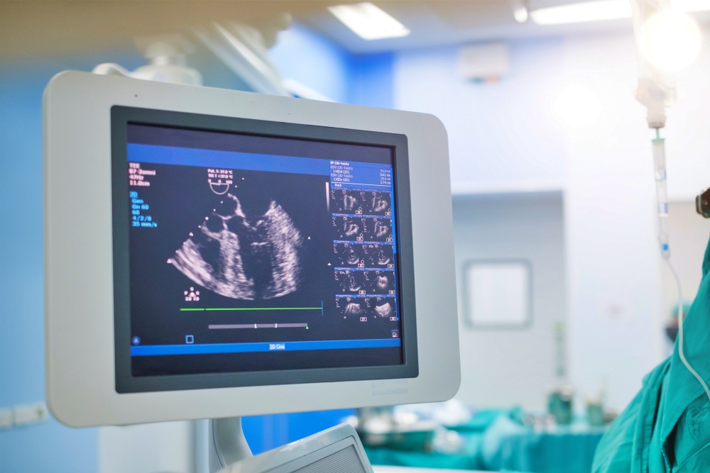心電図検査と心臓超音波（心エコー）検査の違いの画像
