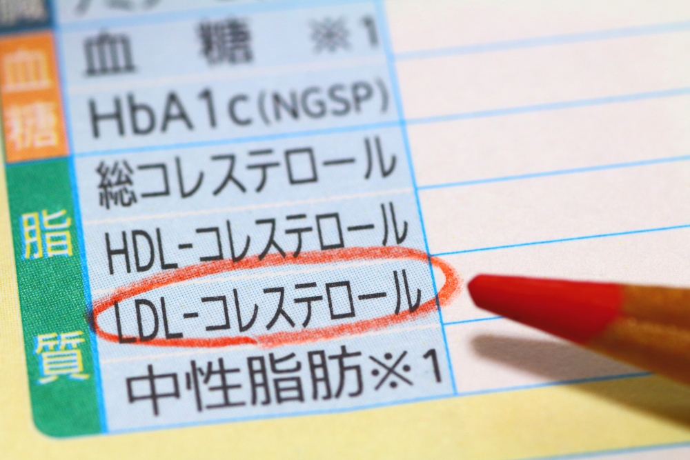 家族性高コレステロール血症の症状と診断基準