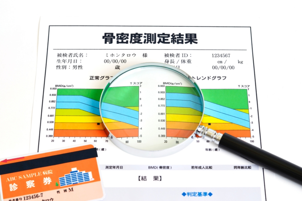 40歳を過ぎたら骨粗しょう症検診（骨密度検査）を！