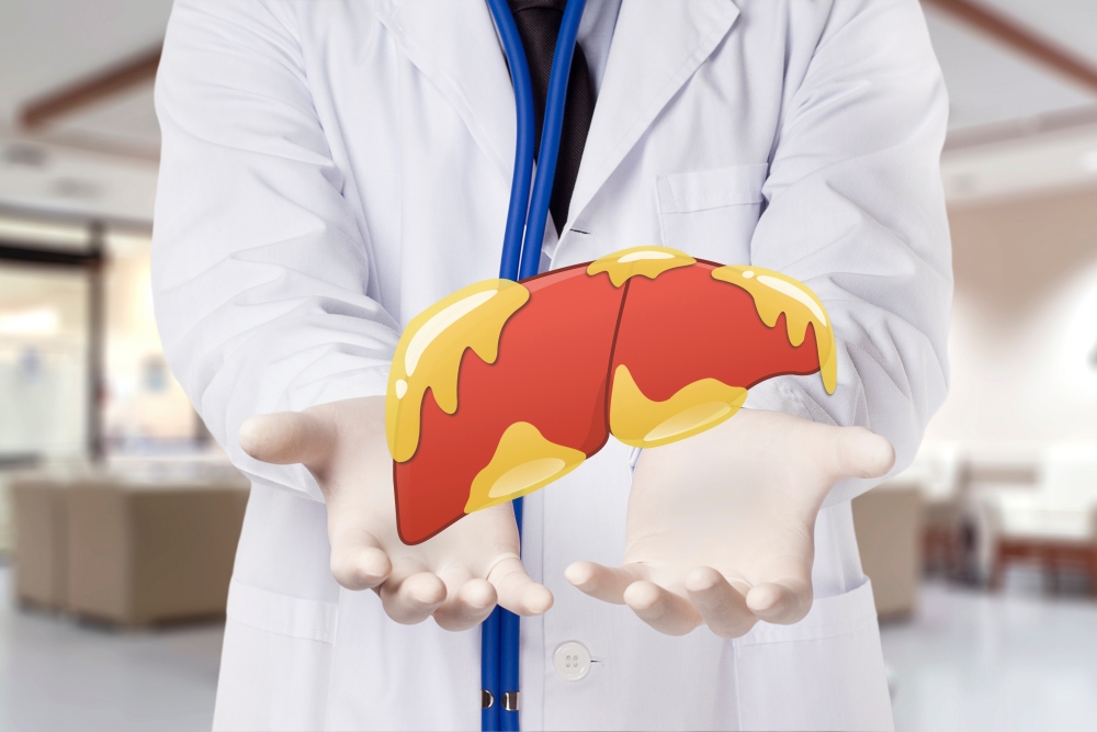 脂肪肝とはどんな病気?