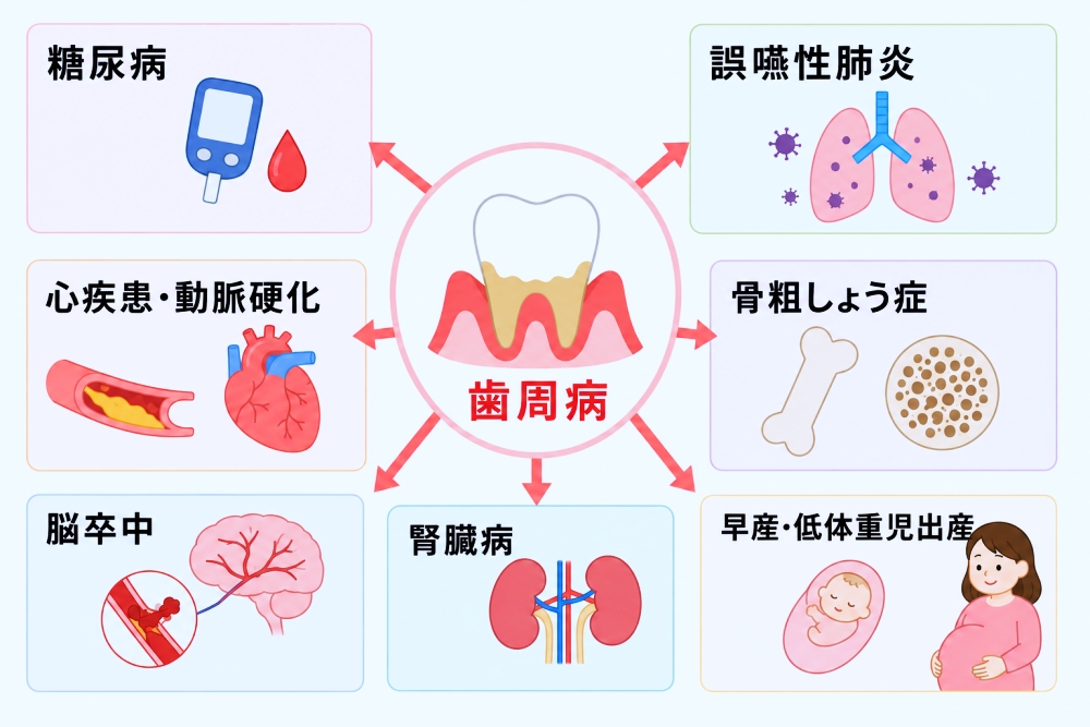 歯周病が影響を与えるとされる全身の病気
